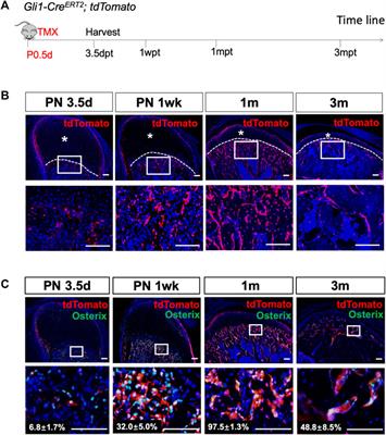 Gli1+ Osteogenic Progenitors Contribute to Condylar Development and Fracture Repair